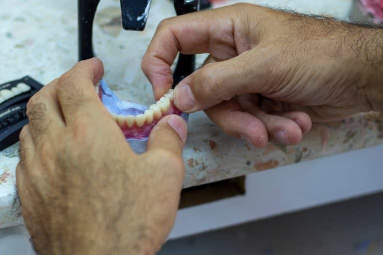 Full Mouth Reconstruction in San Diego
